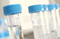 Clinical Trials case study